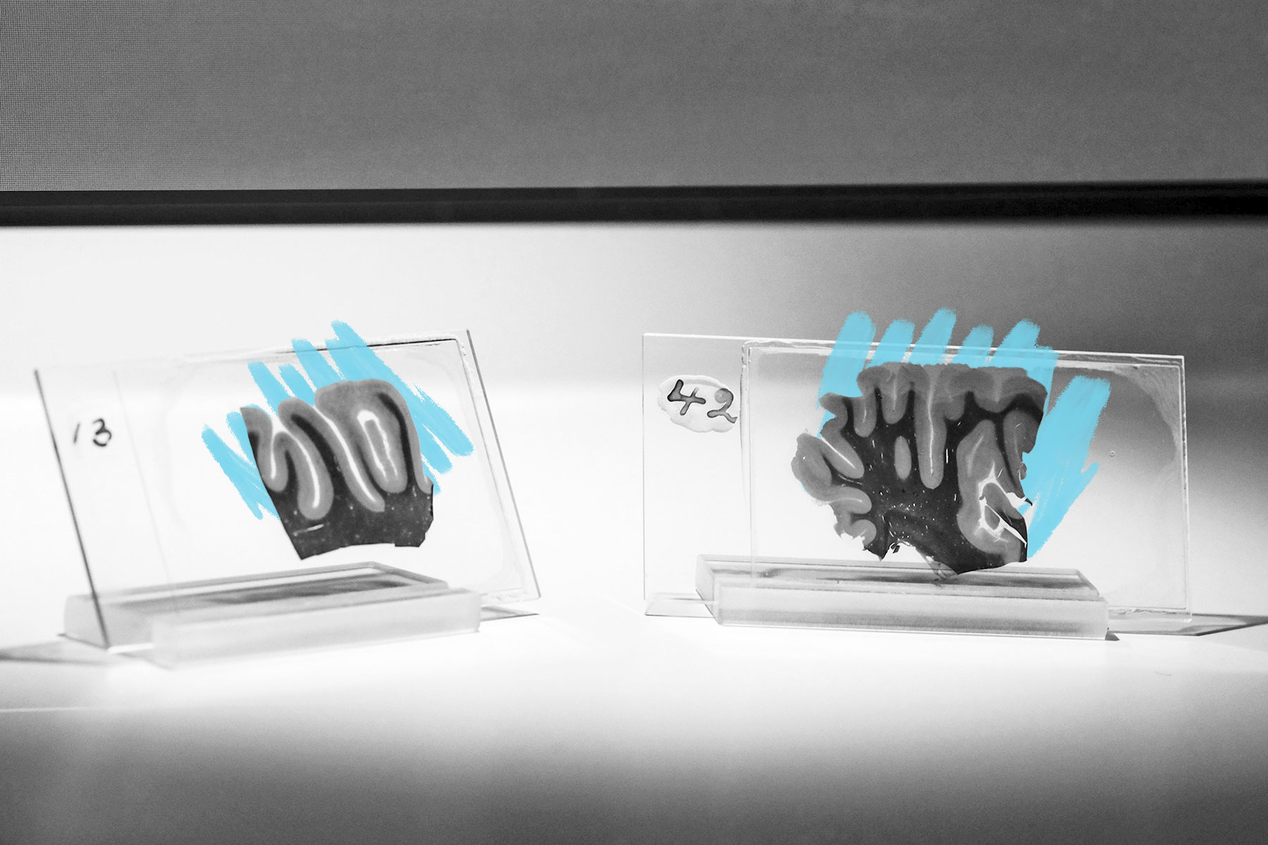 Section of Einstein brain